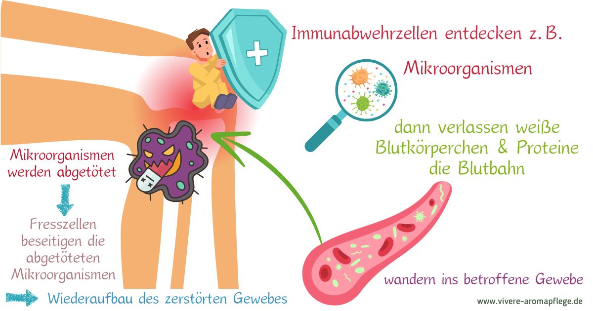 Knie, Ellenbogen, Karpaltunnelsyndrom: Funktionsfähige Gelenke und entspannte Muskeln dank ätherischer Öle